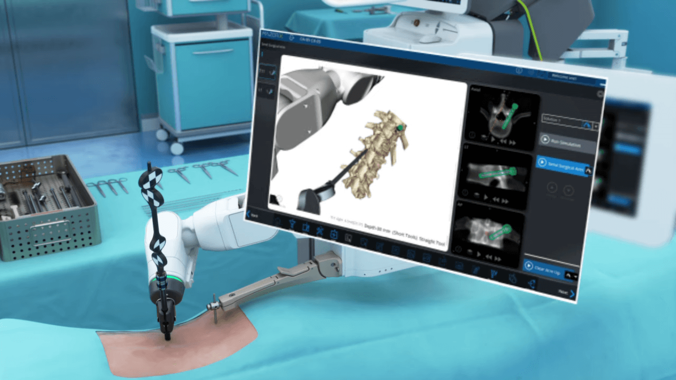 Robotic Spine Surgery IMG 2