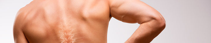 Scoliosis Image Banner